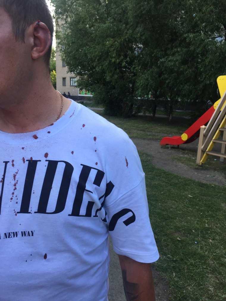В Екатеринбурге водитель BMW обстрелял семейную пару. Он расчищал себе дорогу. ФОТО